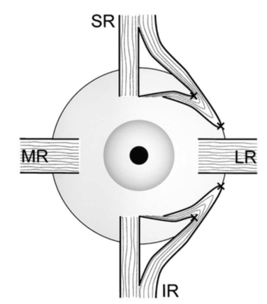 nishida_procedure.png nishida_procedure.png