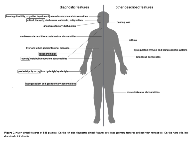 bardet-biedl_syndrome_diagnostic_features.png bardet-biedl_syndrome_diagnostic_features.png