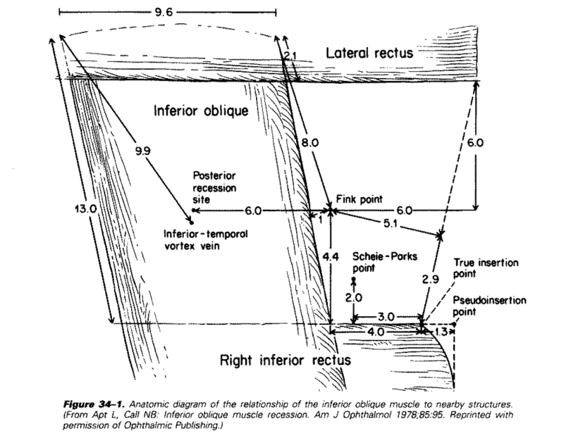 inferior_oblique_surgical_anatomy.png inferior_oblique_surgical_anatomy.png