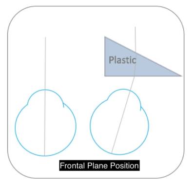 frontal plane position
